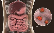 Close-up de ameba parasita no intestino humano, arte digital . — Fotografia de Stock
