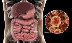Obra de arte digital de microrganismo patogênico abstrato no intestino grosso humano . — Fotografia de Stock