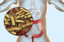 Пищеварительная система человека с инфекцией шигеллёза и крупным планом бактерий шигеллы . — стоковое фото