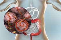 Цифрова ілюстрація декількох потокових черв'яків в кишечнику людини . — стокове фото