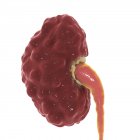 Pielonefritis crónica del riñón, ilustración digital . - foto de stock