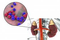 Illustration der unregelmäßig vernarbten kortikalen Oberfläche der Niere und Nahaufnahme von Enterokokken-Bakterien. — Stockfoto