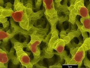 Farbige Rasterelektronenmikroskopie von Mikrostrukturen, die auf Nickeloberflächen entstehen. — Stockfoto