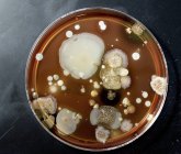 Vista dall'alto dei microbi che crescono sulla piastra di agar . — Foto stock