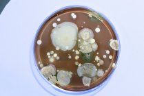 Вид сверху на микробов, растущих на агаровой тарелке . — стоковое фото