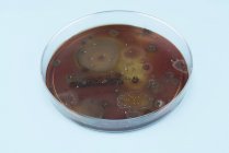 Microbios creciendo en placa de agar sobre fondo azul . - foto de stock
