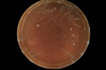 Vista superior de microbios creciendo en placa de agar sobre fondo liso . - foto de stock