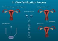 Proceso de fertilización in vitro, ilustraciones digitales . - foto de stock