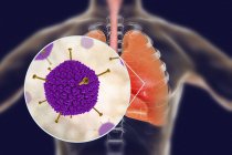 Nahaufnahme von Adenoviren, die menschliche Lungen infizieren, digitale Illustration. — Stockfoto