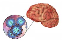 Encefalitis del cerebro humano causada por enterovirus del sarampión, ilustración conceptual . - foto de stock