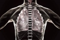 Ilustração digital de nódulo sólido no pulmão direito próximo ao ápice pulmonar enquanto infecção secundária por tuberculose
. — Fotografia de Stock