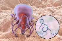 Lyme disease tick and close-up of Borrelia burgdorferi bacterium, digital illustration. — Stock Photo