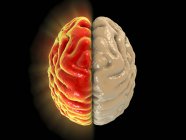 Illustrazione digitale concettuale del cervello con area colorata con emicrania . — Foto stock