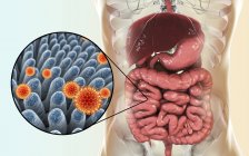 Particules de rotavirus infectant l'intestin humain, illustration numérique . — Photo de stock