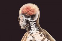 Digital illustration of brain with signs of encephalitis. — Stock Photo