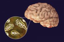Illustration de protozoaires amibes mangeurs de cerveau de Naegleria fowleri infectant le cerveau
. — Photo de stock
