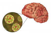 Encefalitis japonesa del cerebro humano, ilustración digital . - foto de stock