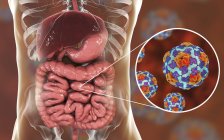 Digital illustration of intestine and close-up of hepatitis A virus particles. — Stock Photo