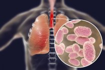 Tosse convulsa doença infecciosa contagiosa dos pulmões e close-up das bactérias Bordetella pertussis . — Fotografia de Stock