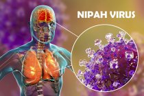 Encefalite e polmonite causate dal virus zoonotico Nipah, illustrazione digitale . — Foto stock