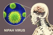 Encefalitis causada por el virus zoonótico de Nipah, ilustración digital . - foto de stock