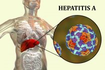 Цифровий ілюстрації силует з запалення печінки і Закри вірусу гепатиту А. — стокове фото