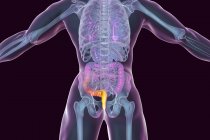 Digital illustration of human body with external haemorrhoids. — Stock Photo