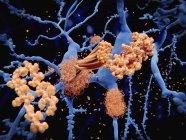 Illustrazione del processo che porta alla formazione di placche proteiche amiloidi sui neuroni nella malattia di Alzheimer . — Foto stock