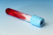 Gros plan de l'échantillon de sang dans une fiole de verre . — Photo de stock