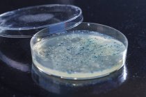 Primo piano delle colonie batteriche che crescono nella capsula di Petri . — Foto stock
