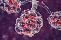Digitale Illustration von stäbchenförmigen Bakterien in Lungenbläschen, die bakterielle Lungenentzündung verursachen. — Stockfoto