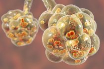 Digitales Kunstwerk von Streptococcus pneumoniae Bakterien in Lungenbläschen, die Lungenentzündung verursachen. — Stockfoto