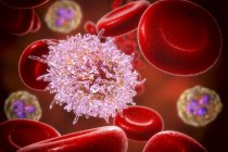 Ilustración digital de células sanguíneas anormales infectadas por leucemia de células pilosas . - foto de stock