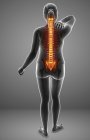 Female silhouette with back pain, digital illustration. — Stock Photo