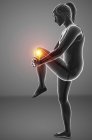 Silhueta feminina com dor no joelho, ilustração digital . — Fotografia de Stock