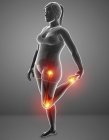 Silueta femenina con dolor en las piernas, ilustración digital . - foto de stock