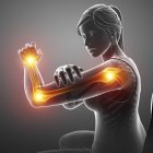 Silueta femenina con dolor en el brazo, ilustración digital . - foto de stock