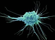 Кольорові сканування електрон мікрофотографія захисні Дендритні клітини імунної системи. — стокове фото