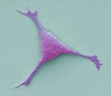 Micrografia eletrônica de varredura colorida de células de câncer de mama . — Fotografia de Stock