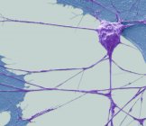Micrografia eletrônica de varredura colorida de células-tronco de neurônios motores derivados de células-tronco . — Fotografia de Stock