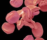 Colored scanning electron micrograph of red blood cells. — Stock Photo