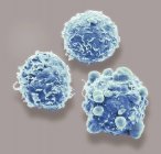 Micrographie électronique à balayage coloré des cellules cancéreuses du côlon humain
. — Photo de stock