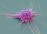 Farbige Rasterelektronenmikroskopie der schützenden dendritischen Zelle des Immunsystems. — Stockfoto