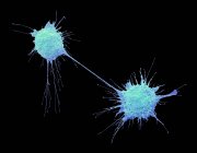 Células cancerosas de próstata divididas, micrografía electrónica de barrido coloreada
. - foto de stock