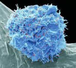 Coloured scanning electron micrograph of 293T cell infected with human immunodeficiency virus. — Stock Photo