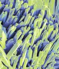 Micrografia eletrônica de varredura colorida abstrata da superfície cristalina da pedra biliar fraturada . — Fotografia de Stock