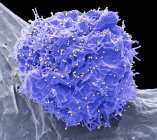 Micrógrafo electrónico de barrido coloreado de células 293T infectadas con el virus de la inmunodeficiencia humana . - foto de stock