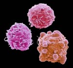 Цветной сканирующий электронный микрограф раковых клеток толстой кишки человека
. — стоковое фото