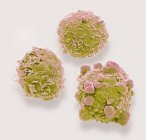 Micrografia eletrônica de varredura colorida de células cancerosas do cólon humano . — Fotografia de Stock