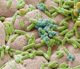 Coloured scanning electron micrograph of bacteria cultured from used dishcloth. — Stock Photo
